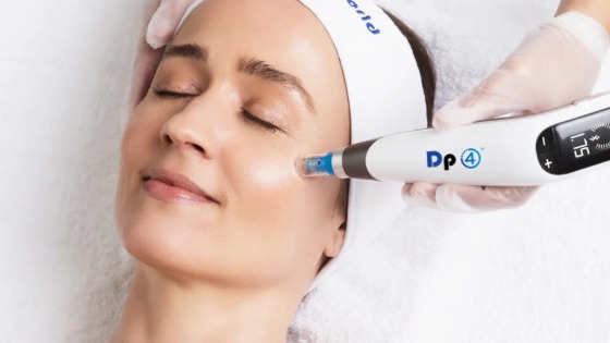 Microneedling
